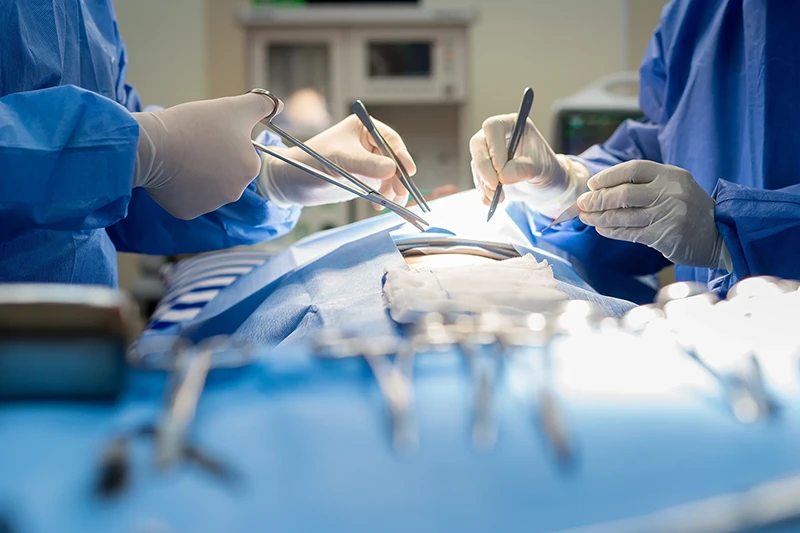 Operacja - chirurgia ogólna.